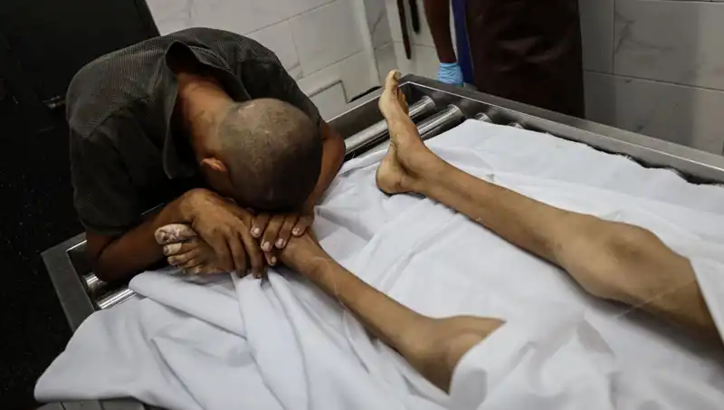 Gazze’de Açlık Nedenli Trajedi: Bir Çocuğun Hayatına Mal Oldu