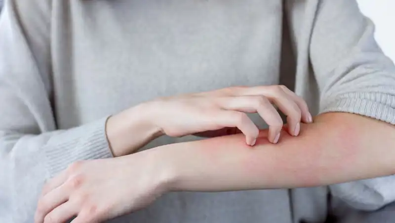 Cilt Kanserinin Görmezden Gelinen İki Önemli İşareti: Dermatologlar Uyarıyor!